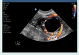 <p>what ovarian phase is this?</p>