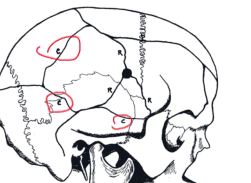 <p>= C, concentric heaving fracture patterns</p>