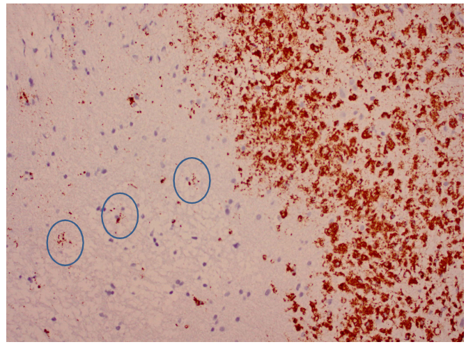 <ul><li><p>bruin = geactiveerde microgliacellen</p></li></ul><p></p>