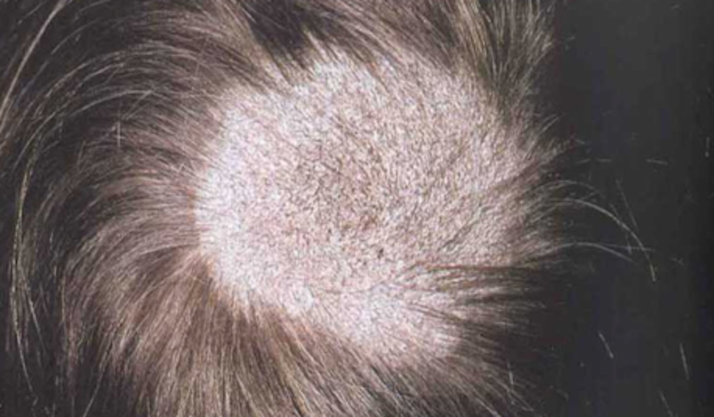 <p>What is the diagnosis?</p>