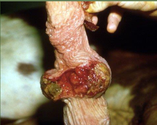 <p>What is this?</p><p>Cuased by?</p><p>DX?</p><p>Impact?</p><p>TX.MX?</p>
