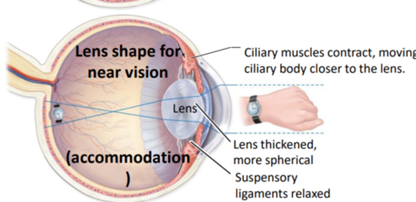 <p>Ciliary muscles contract, moving ciliary body closer to the lens</p><p>- lens thickened, more spherical, suspensory ligaments relaxed</p>