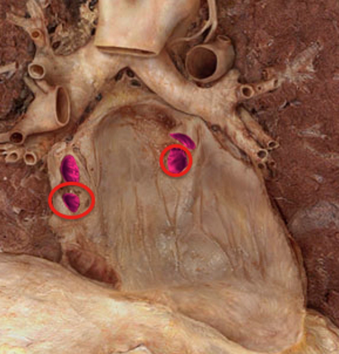 <p>Name the Structure of the Left Atrium</p>