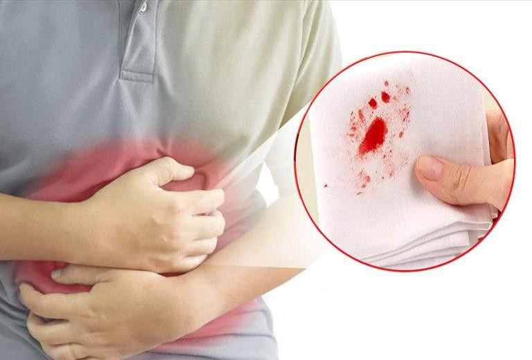 <p>Haemorrhage/ˈhem.ər.ɪdʒ/(v)</p>