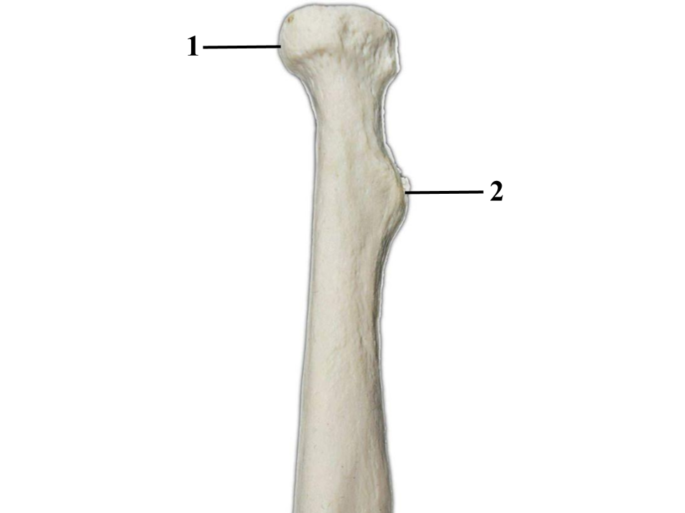 <p>What bone is this?</p>