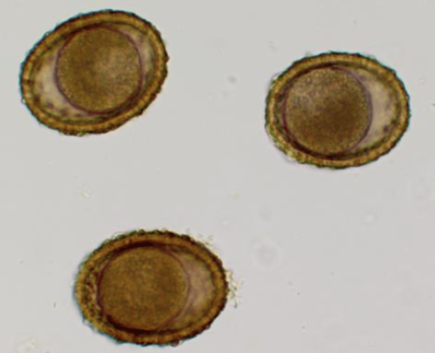 <p>What is the scientific name of this worm eggs?</p>