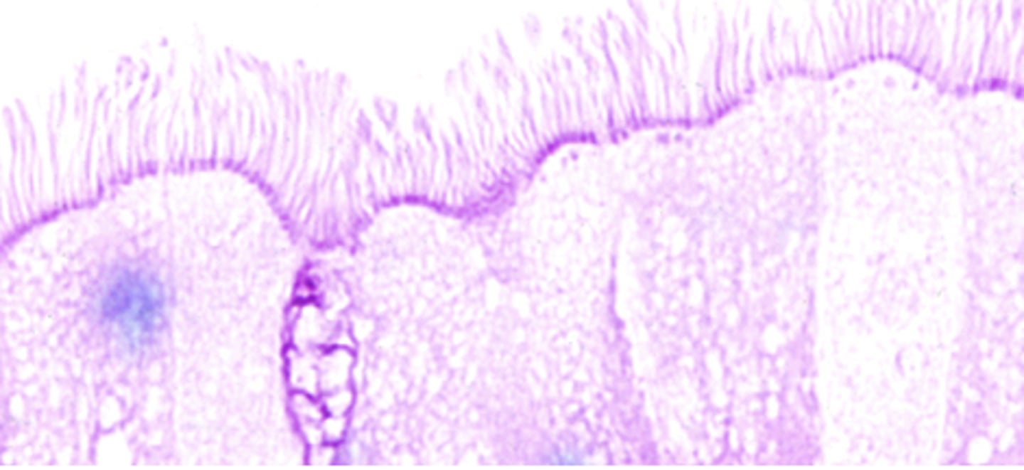 <p>What is this stained for? (darker purple underneath cilia)</p>