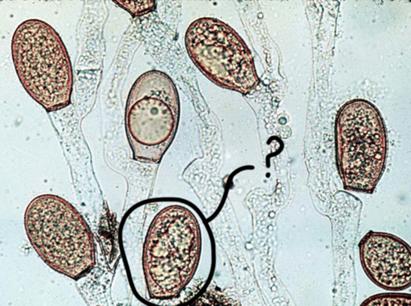 <p>A capsule in fungi in which haploid spores develop.</p>