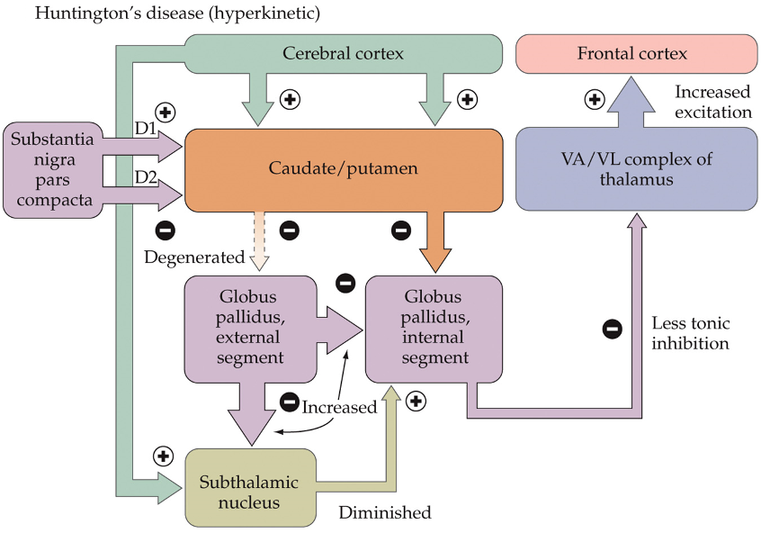 <ul><li><p>ex. Huntington’s disease</p><ul><li><p>insufficient output from the pallidus → unwanted, jerky movements</p></li><li><p>atrophy of striatum</p></li><li><p>excitatory subthalamic nucleus can’t effectively oppose the direct pathway → cortex is more excited by the thalamus → excessive movement</p></li></ul></li></ul><p></p>