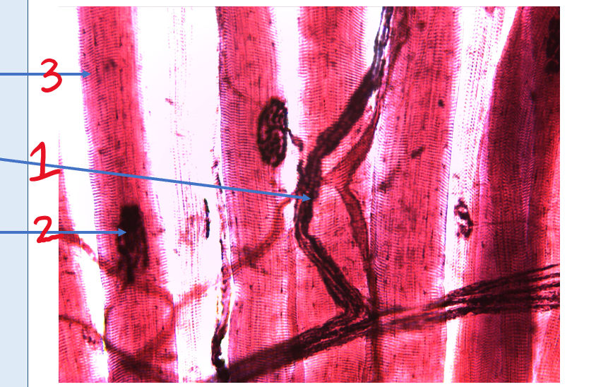 Motor Nerve Ending #2