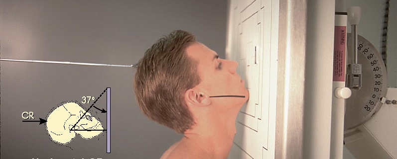 <p>What position is this?</p>