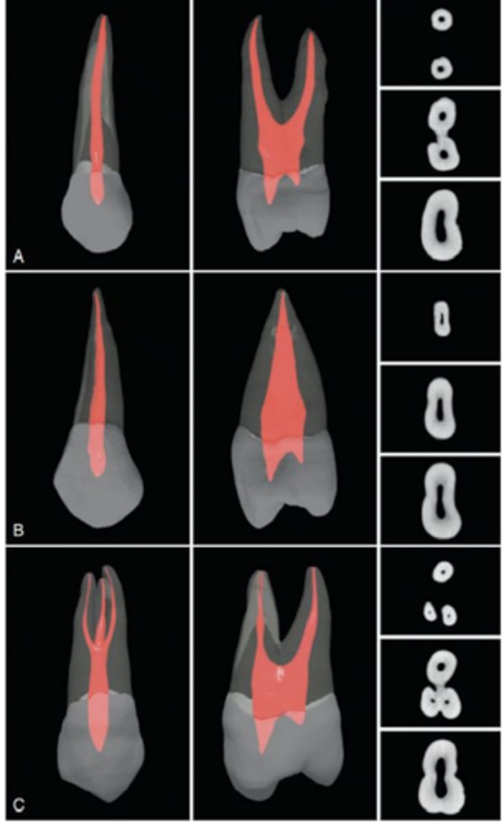<p>kidney/figure 8/hourglass</p>