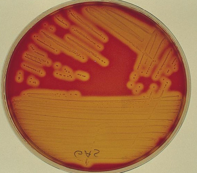 <p>complete cell lysis</p>