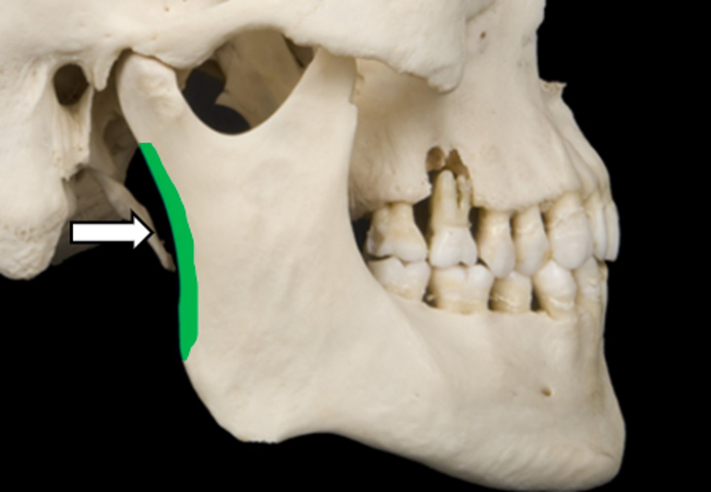 <p>name the part</p>