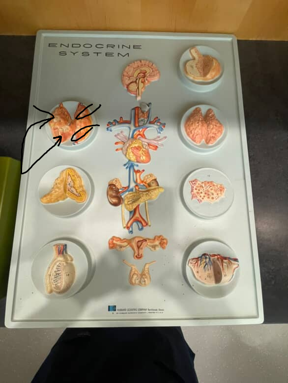 <p>4 amber colored dots on the back view of the thyroid gland</p>