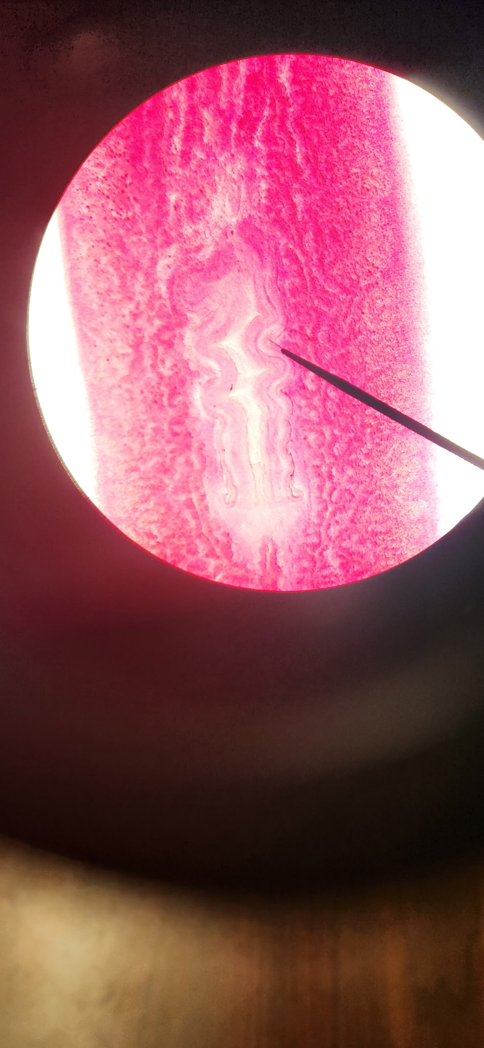 <p>What part of the planaria is this</p>