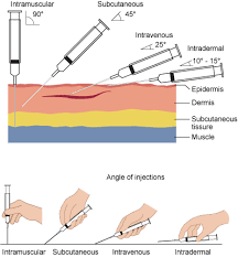 <p>Parenteral</p>