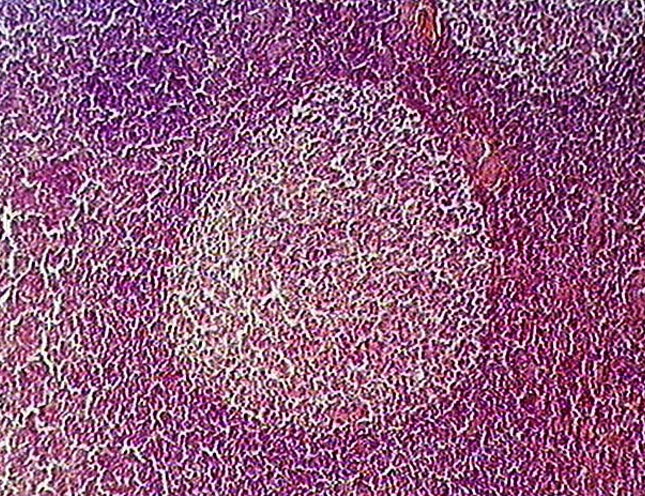 <p><strong>Lymphatic nodules</strong></p><p><em>Nodule w/ lighter staining germinal center</em></p>