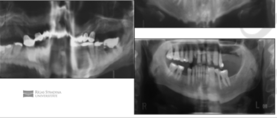 <p>Patient position - Movement</p>