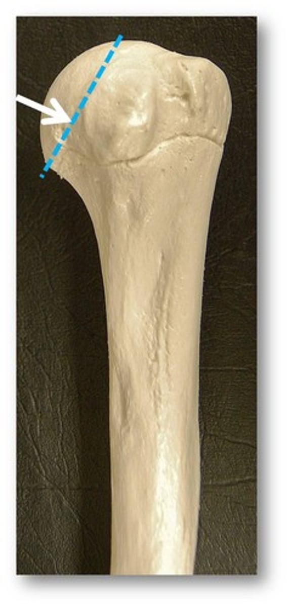 <p>Name the specific part of this bone indicated by the blue line.</p>