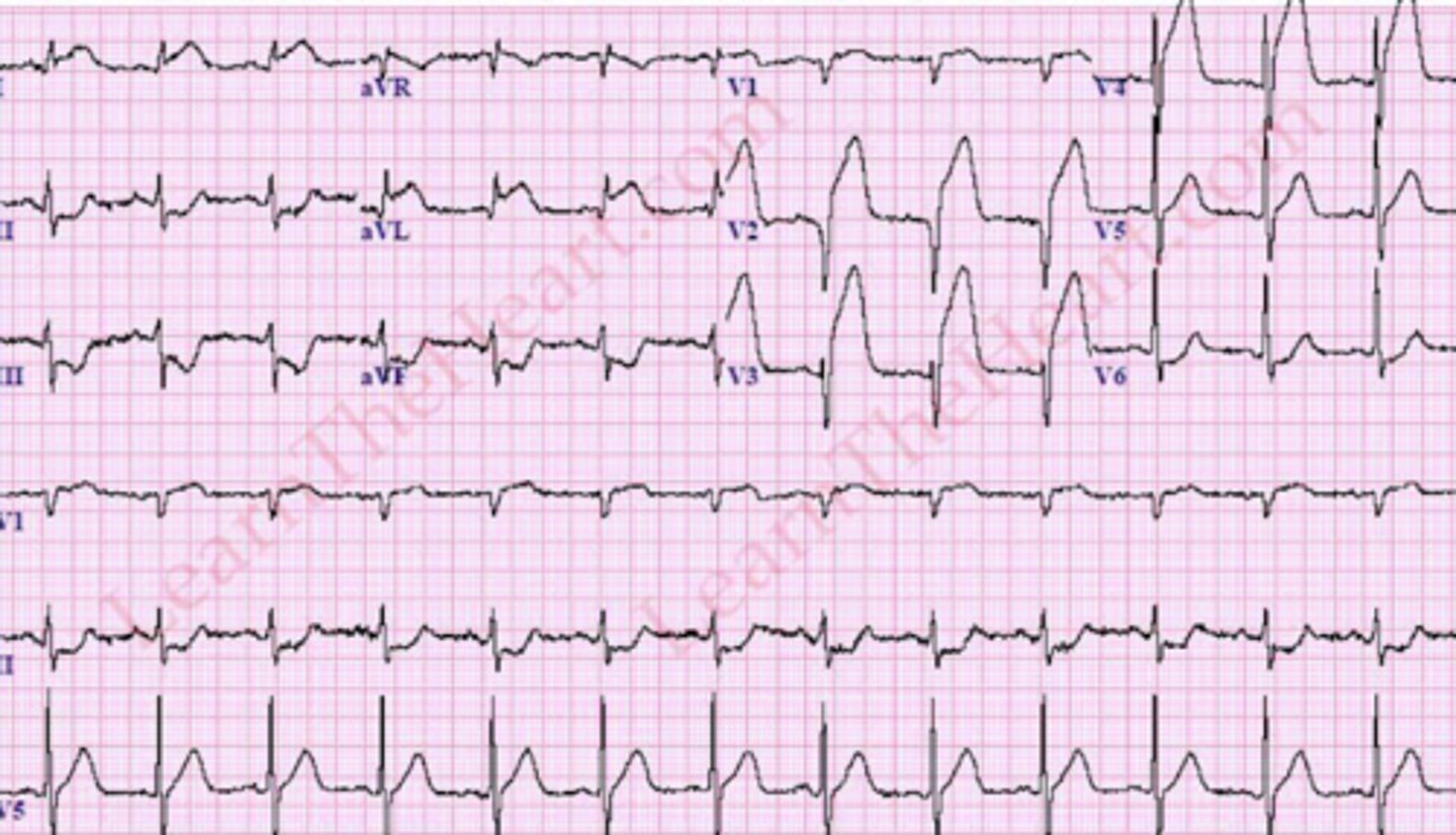 <p>What are the findings</p>