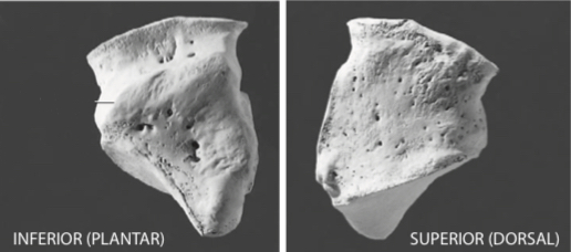 <p>Lop-sided cube-shaped tarsal that pinches inwards on the lateral side</p>