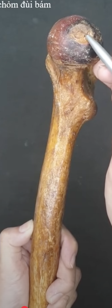 <p><span style="color: blue"><strong>Chỏm xương đùi</strong></span><span style="color: red"><strong> (Head of femur) </strong></span>được che phủ bởi sụn khớp, ngoại trừ:</p><p>A. Toàn bộ bề mặt chỏm xương đùi<br>B. Hõm chỏm xương đùi (<strong>fovea capitis</strong>)<br>C. Vùng nối giữa chỏm và cổ xương đùi<br>D. Bề mặt tiếp xúc với ổ cối</p>
