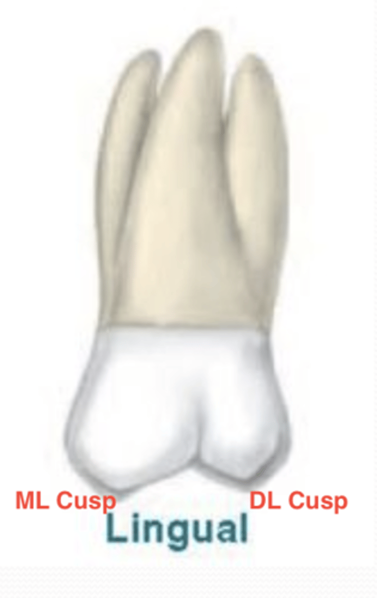 <p>no cusp of Carabelli</p><p>DL cusp is smaller and shorter than on a Mx 1st molar and is sometimes not present</p><p>ML cusp is biggest (same as Mx 1st molars)</p><p>Distolingual groove</p>