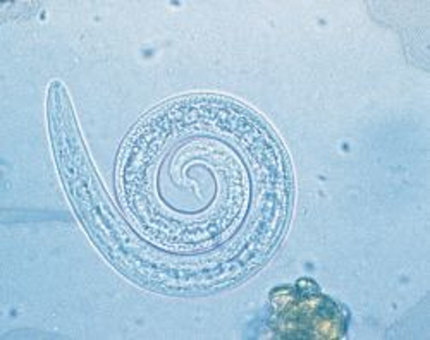 <p>Aelurostrongylus abstrusus</p>