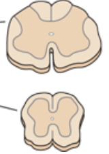 <p>overweight butterfly</p>