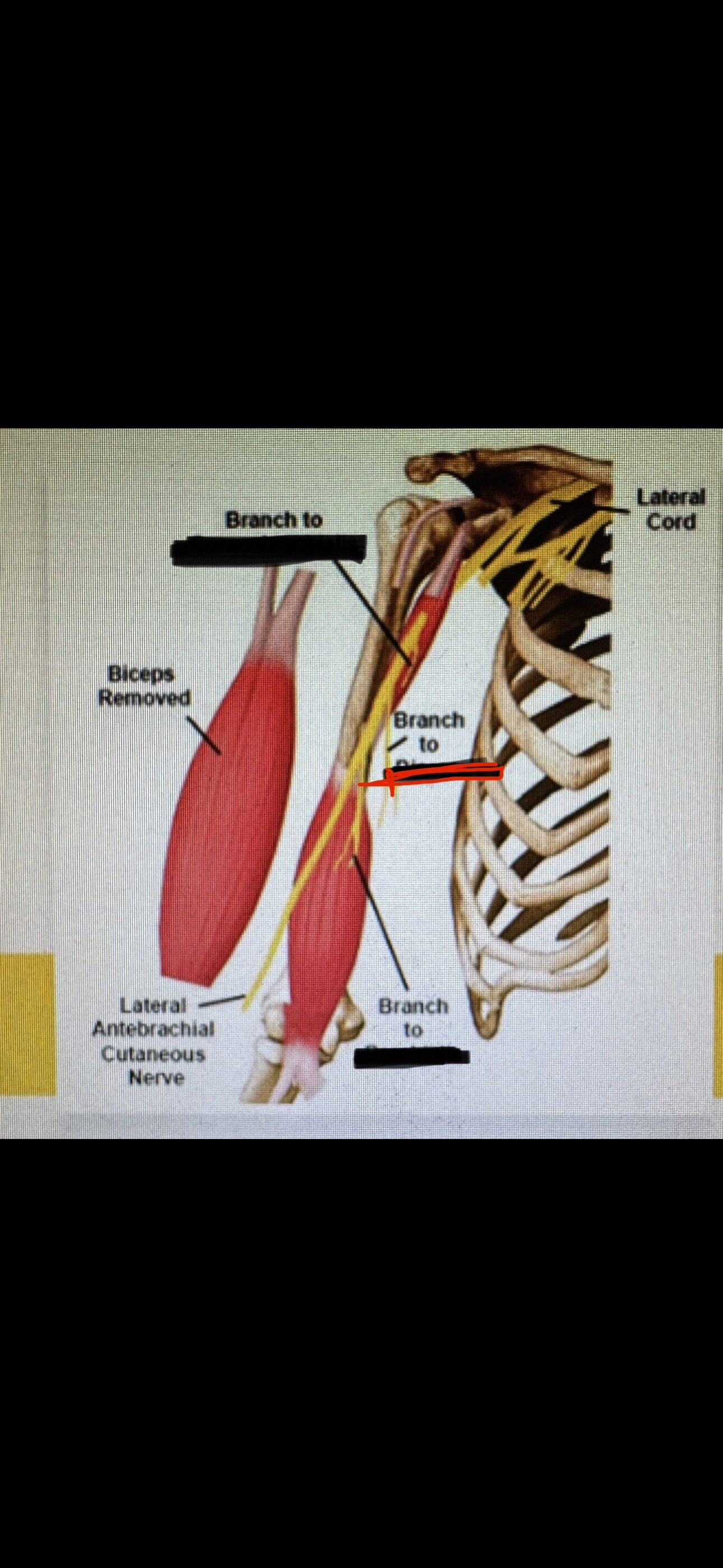<p>musculocutaneous (bra-is)</p>