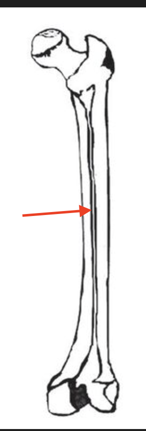 <p>the line straight down the leg</p>