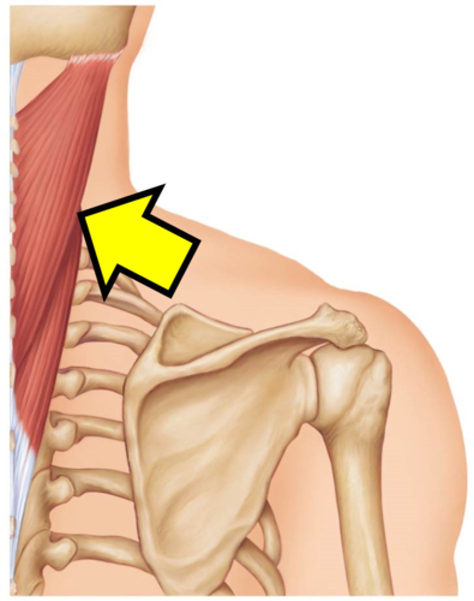 <p>Name the muscle</p>
