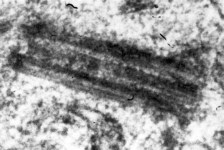 <p>Welk onderdeel van de cel is dit?</p><p>Wat is de functie hiervan?</p>