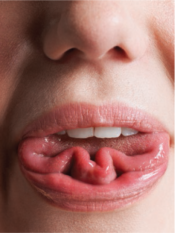 tongue