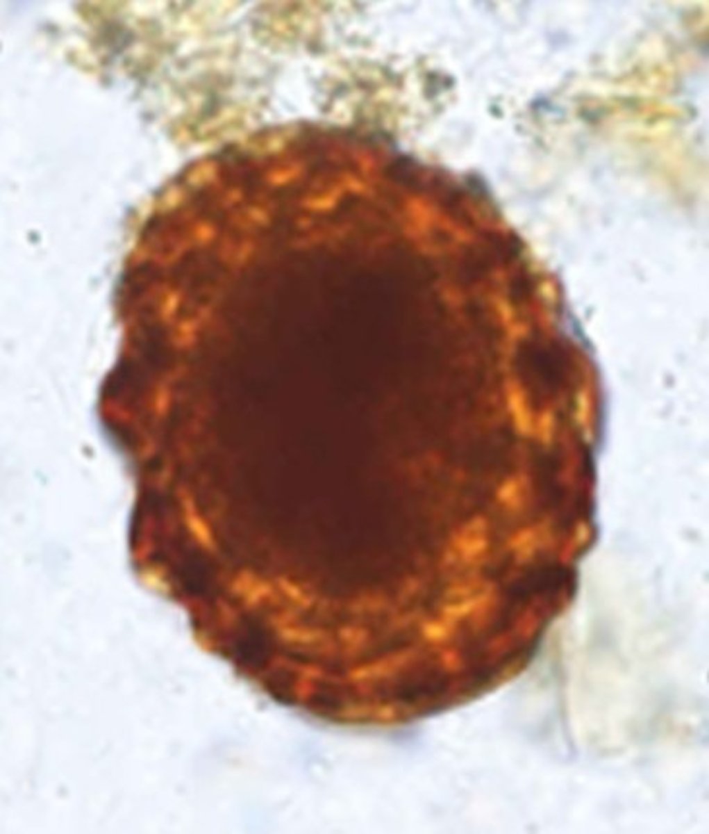 <p>Identify the parasite</p>