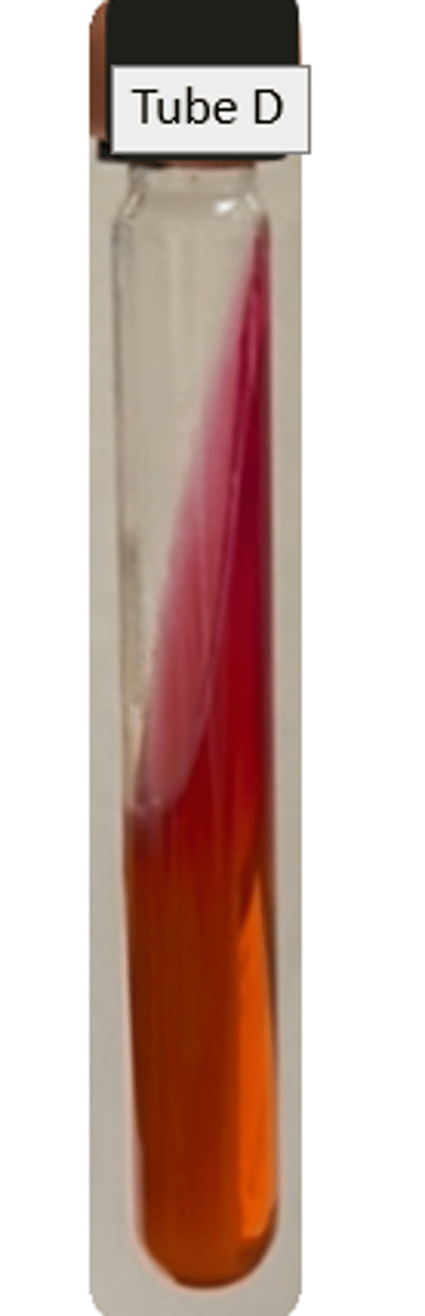 <p>Slant: alkaline</p><p>Butt: alkaline</p><p>Gas: neg</p><p>H2S: neg</p>