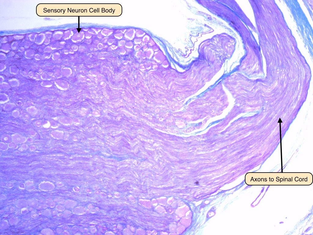 <p>The depicted microscopic slide shows a _______</p>