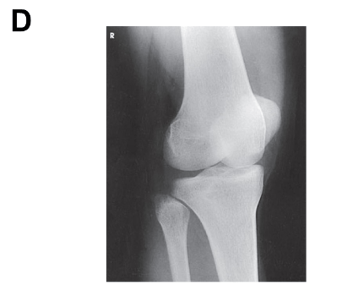 <p>Identify the projection. (Be prepared to critique for positioning on the quiz)</p>