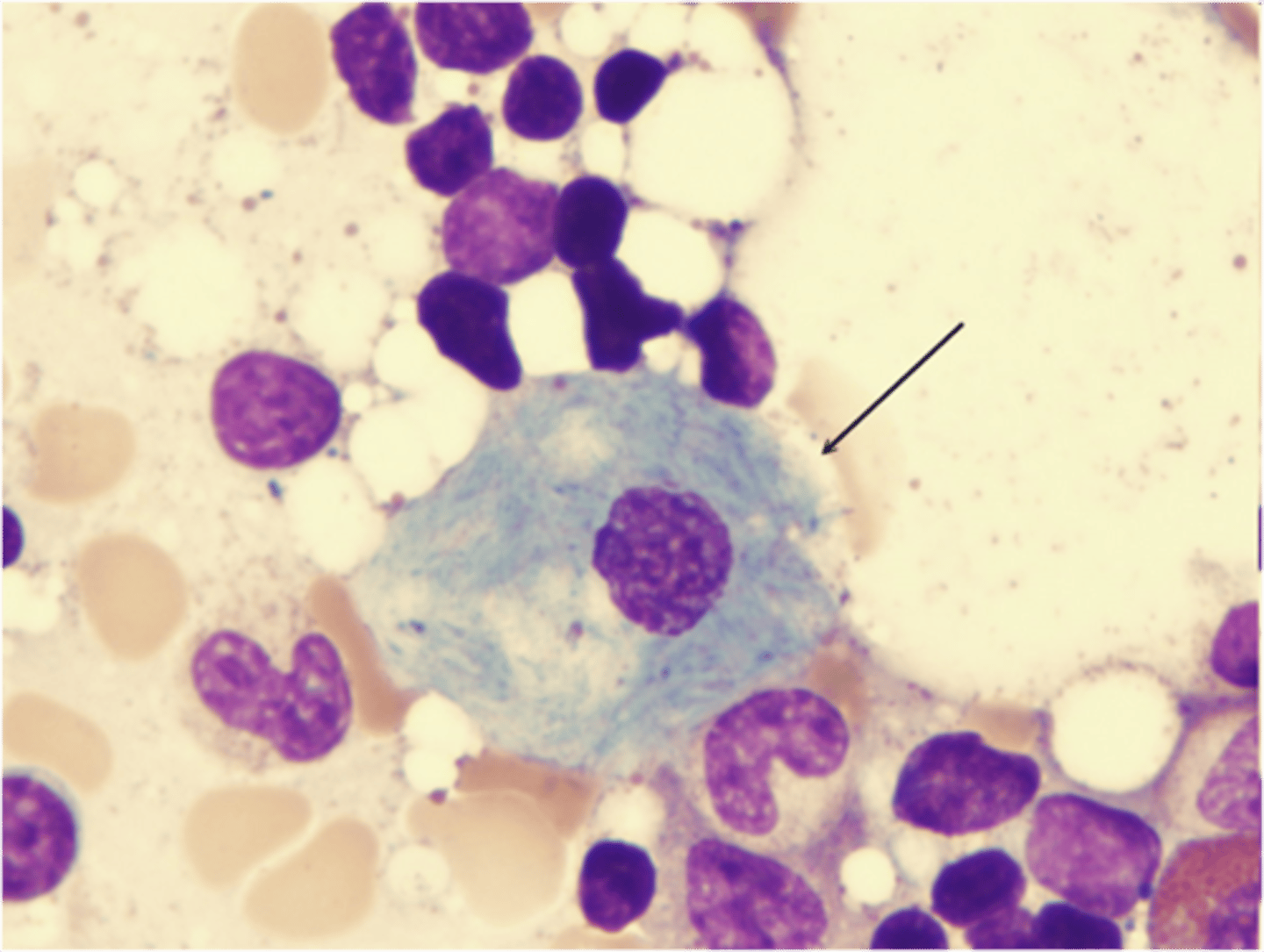 <p>histo of macrophage 2</p>