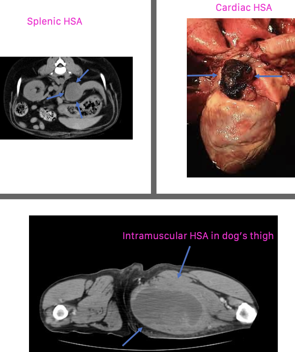 <p>can occur anywhere:</p><p>1. visceral</p><p>2. cardiac</p><p>3. dermal/SQ/intramuscular</p>