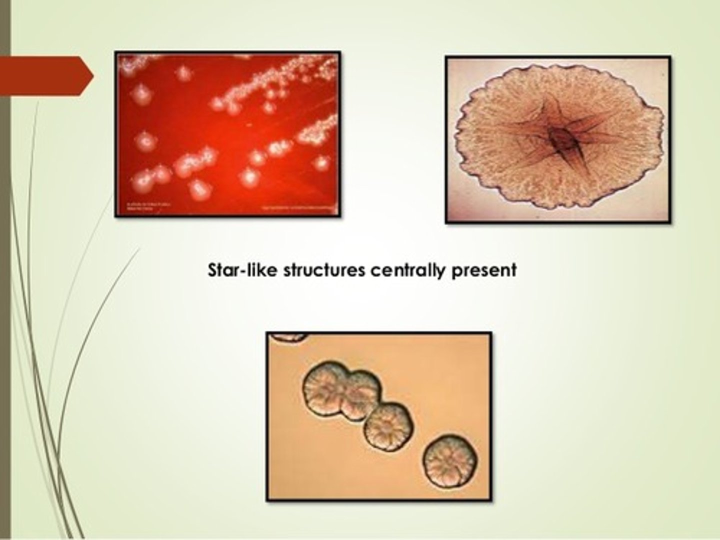 <p>- -ve coccobacillus</p><p>- facultative anaerobe</p><p>- key pathogen in aggressive periodontitis</p><p>- prod leukotoxin &amp; endotoxin.</p><p>- star-shaped colonies on agar</p><p>- catalase +ve</p>