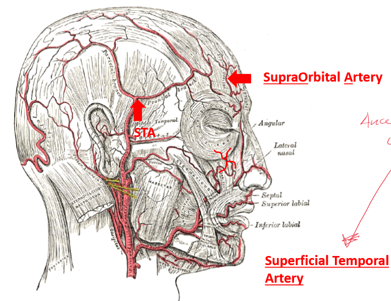 <p>Supratrochlear artery and Superficial Temporal Artery (ECA)</p>