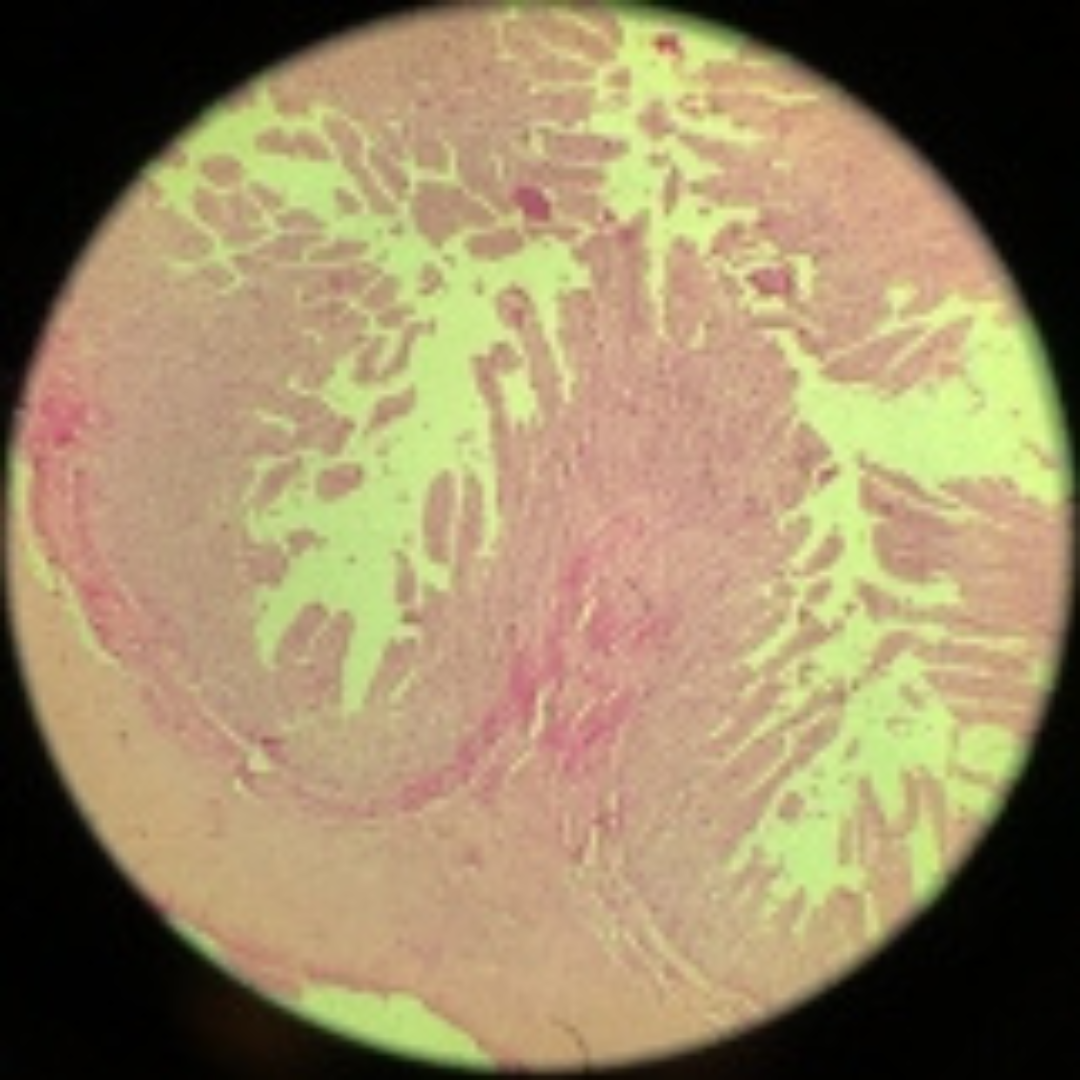 term image