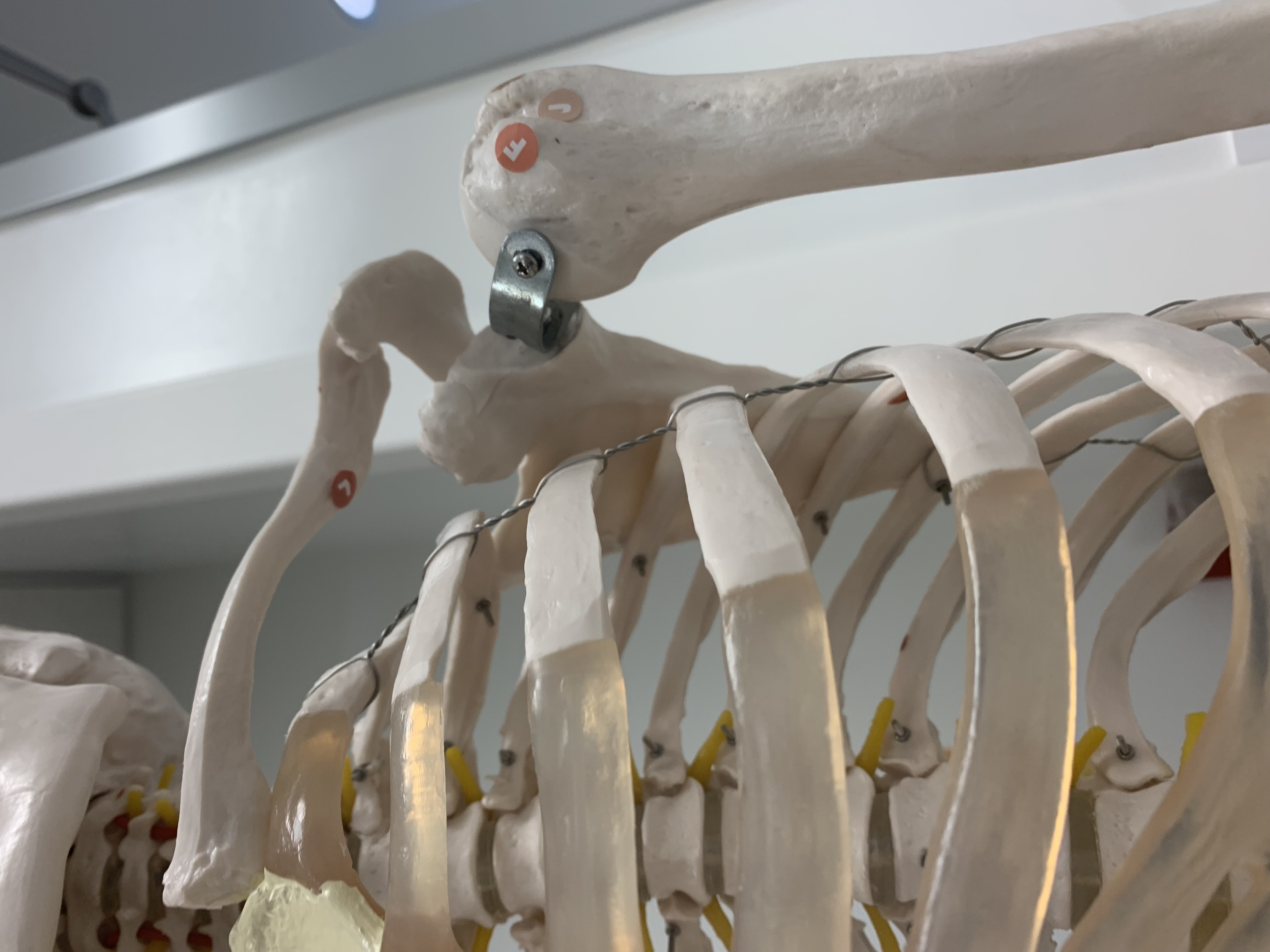 <p>Lesser Tubercle</p>