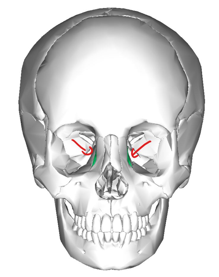 term image