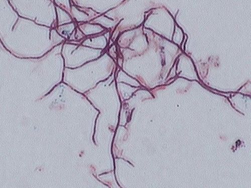 *Gram positive*, form branched structures, found in soil and decaying matter, not human pathogens