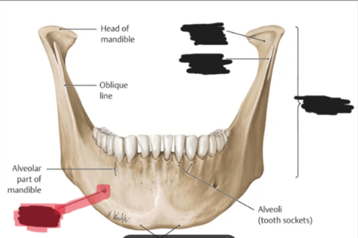 <p>Mental foramen of the mandible</p>