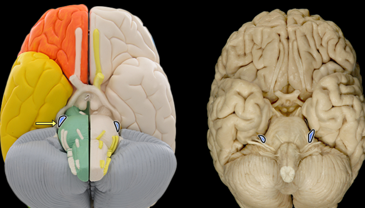 <p>Trigeminal CN V</p>