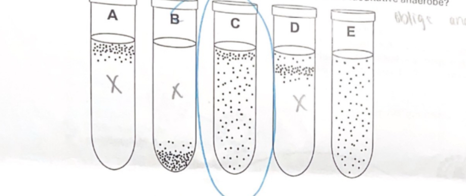 <p><span>Which of the following culture tubes most likely contains a facultative anaerobe?</span></p>